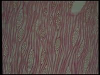 Tangential section