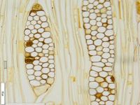 Tangential section