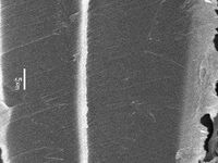 Radial section