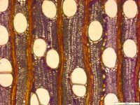 Transversal section
