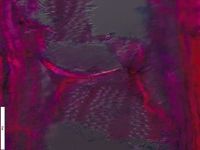 Radial section