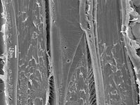 Radial section