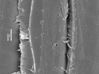 Radial section