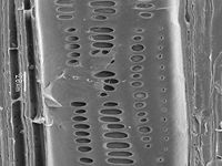 Radial section