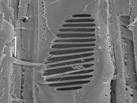 Radial section