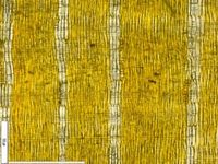 Radial section