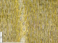 Tangential section