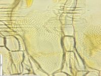 Radial section