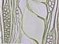 Tangential section