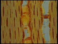 Tangential section