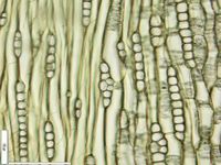 Tangential section