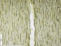 Tangential section